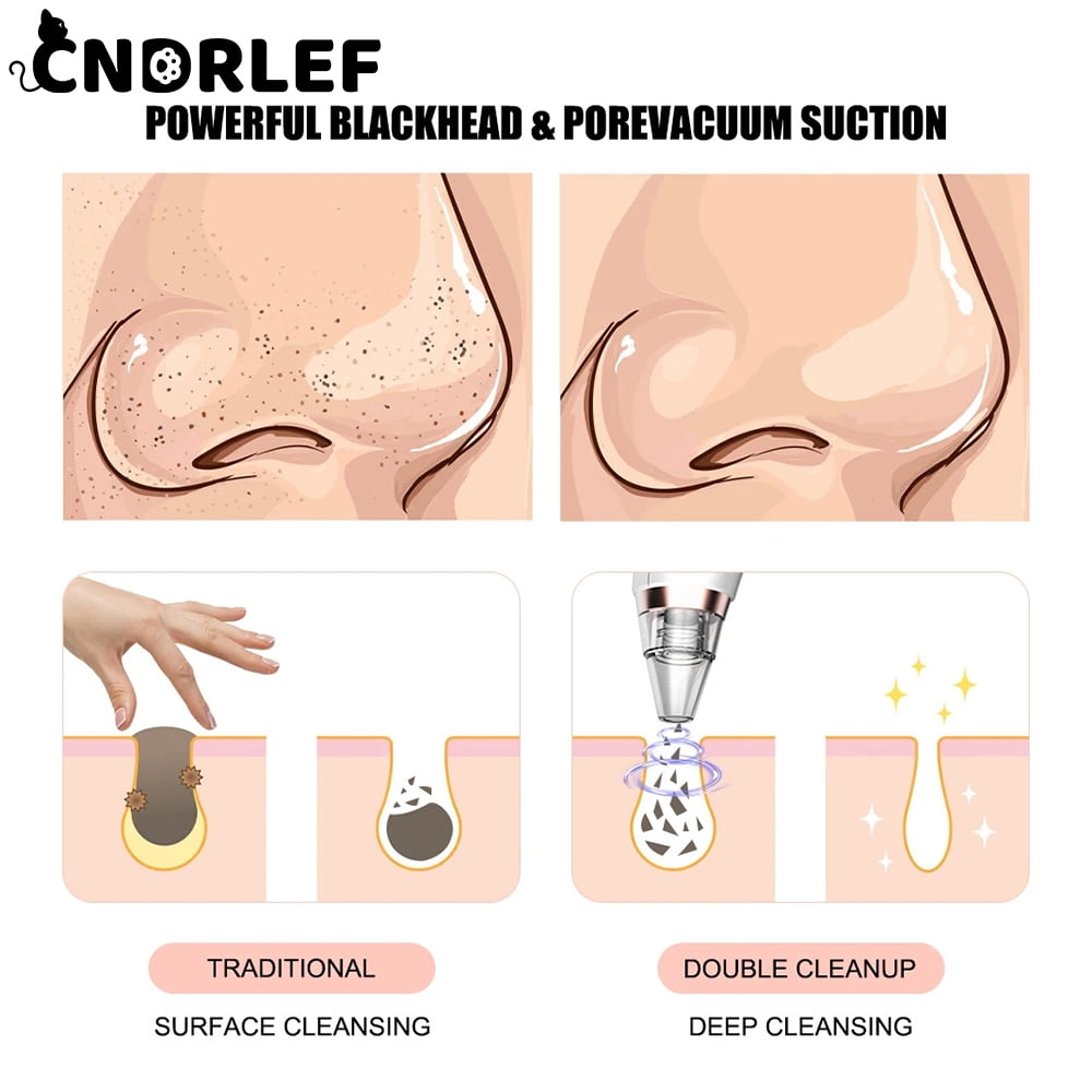 CNDRLEF  Latest Blackhead Remover Pore Vacuum Kit - 10 Pc Set w/1 Host, 5 Suction Probes, 4 Comedone Extractors, 3 Power Levels & USB Rechargeable Facial Tool