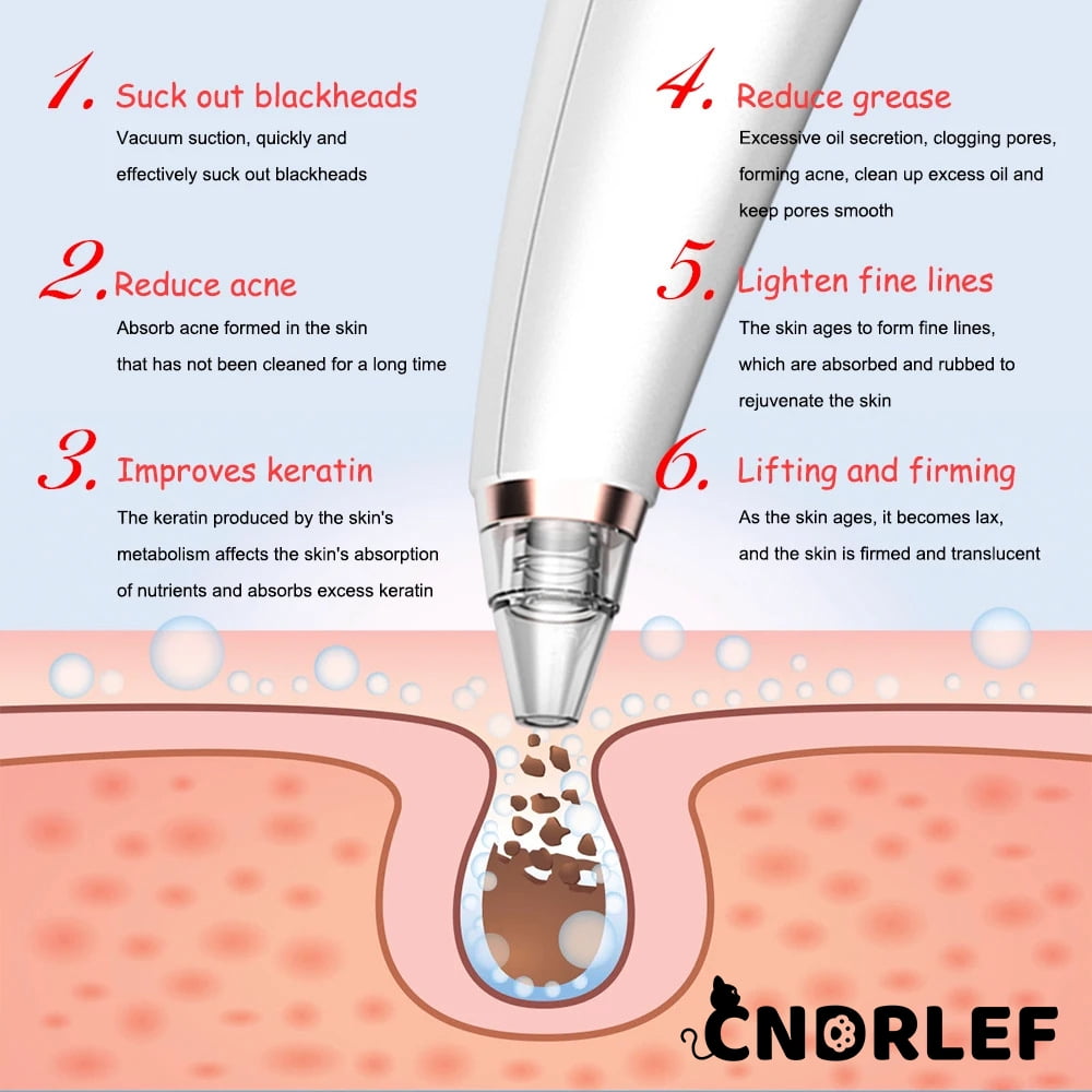 CNDRLEF  Latest Blackhead Remover Pore Vacuum Kit - 10 Pc Set w/1 Host, 5 Suction Probes, 4 Comedone Extractors, 3 Power Levels & USB Rechargeable Facial Tool